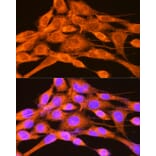 Immunofluorescence - Anti-PHKG2 Antibody (A308523) - Antibodies.com