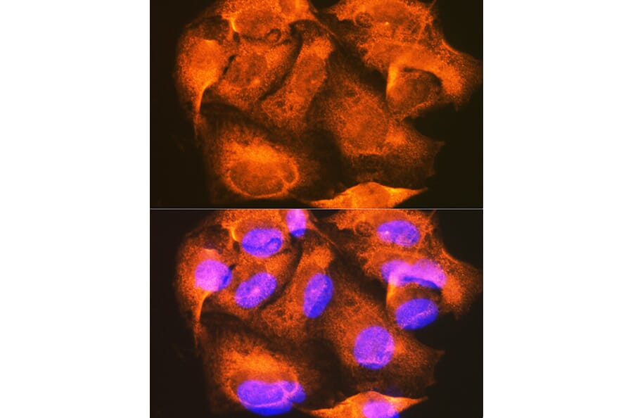 Immunofluorescence - Anti-PHKG2 Antibody (A308523) - Antibodies.com