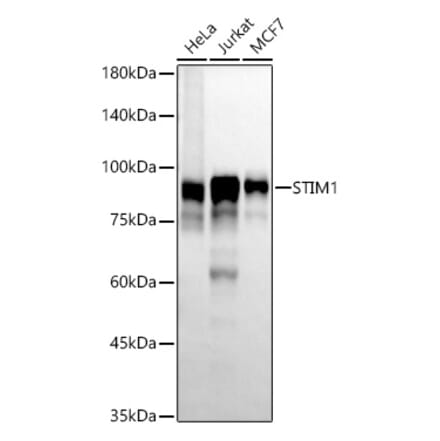 Western Blot - Anti-Stromal interaction molecule 1 Antibody [ARC57102] (A308524) - Antibodies.com