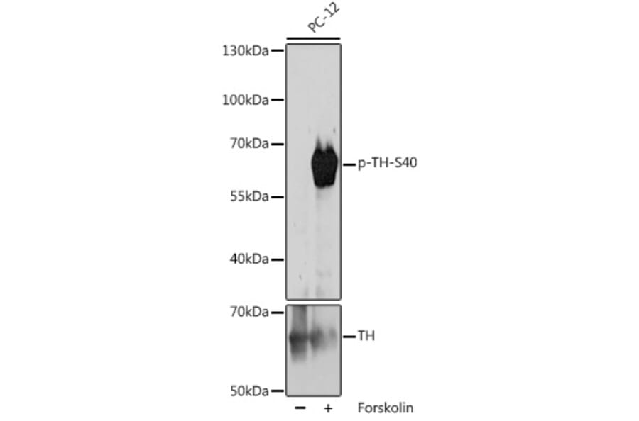 Western Blot - Anti-Tyrosine Hydroxylase (phospho Ser40) Antibody (A308525) - Antibodies.com