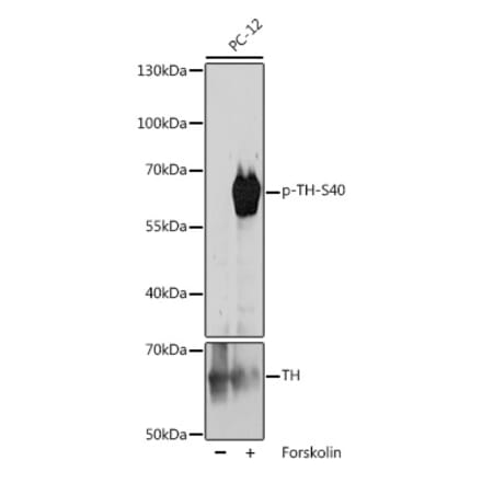 Western Blot - Anti-Tyrosine Hydroxylase (phospho Ser40) Antibody (A308525) - Antibodies.com
