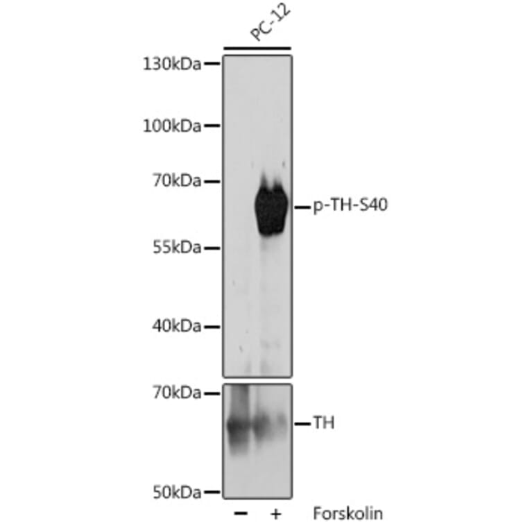 Western Blot - Anti-Tyrosine Hydroxylase (phospho Ser40) Antibody (A308525) - Antibodies.com