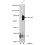 Western Blot - Anti-Tyrosine Hydroxylase (phospho Ser40) Antibody (A308525) - Antibodies.com