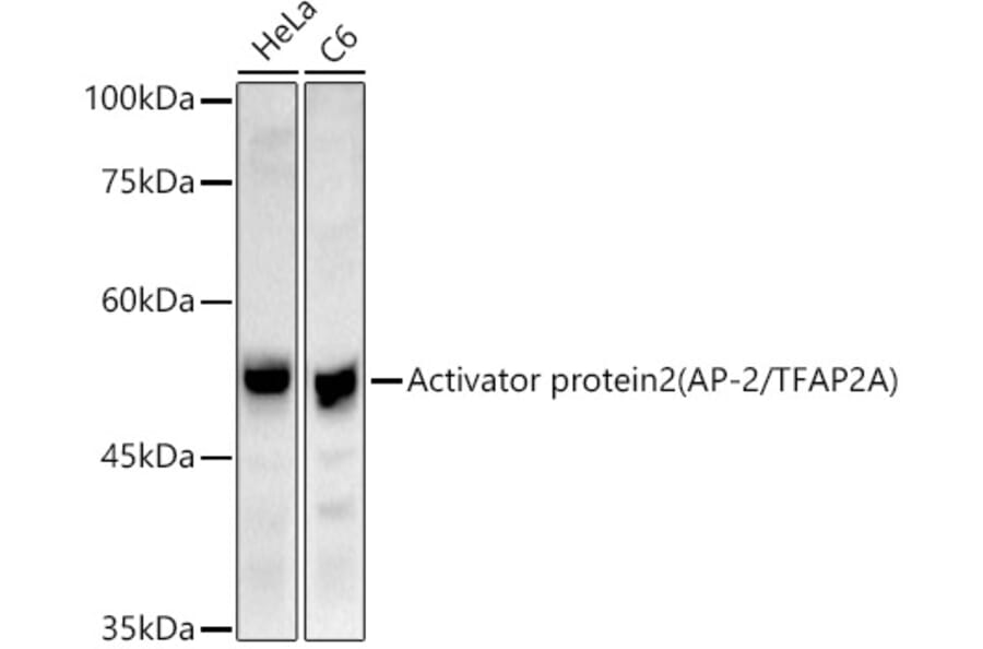 Western Blot - Anti-Transcription factor AP-2-alpha Antibody (A308526) - Antibodies.com