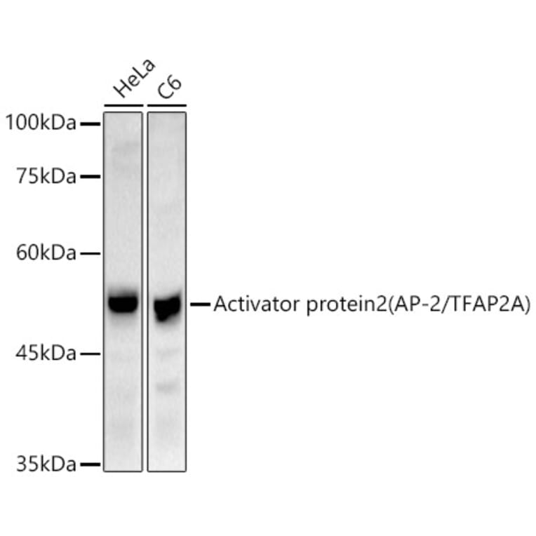 Western Blot - Anti-Transcription factor AP-2-alpha Antibody (A308526) - Antibodies.com