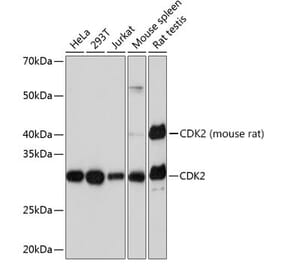 Western Blot - Anti-CDK2 Antibody [ARC0222] (A308527) - Antibodies.com