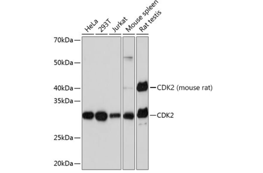 Western Blot - Anti-CDK2 Antibody [ARC0222] (A308527) - Antibodies.com