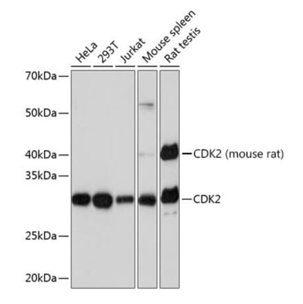 Western Blot - Anti-CDK2 Antibody [ARC0222] (A308527) - Antibodies.com
