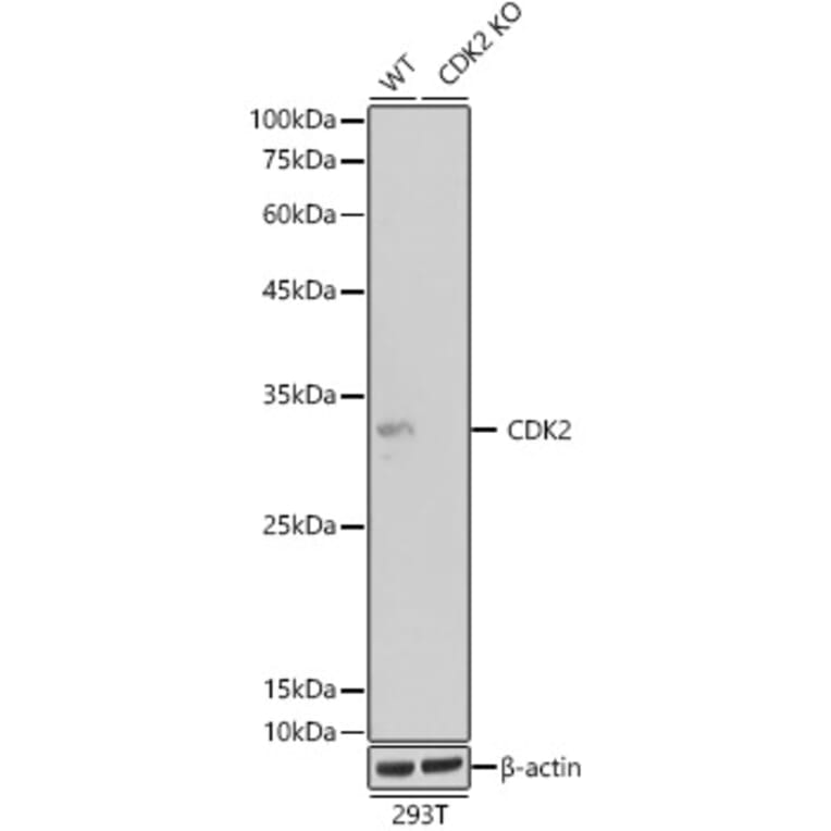 Western Blot - Anti-CDK2 Antibody [ARC0222] (A308527) - Antibodies.com