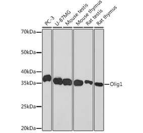 Western Blot - Anti-Olig1 Antibody [ARC1850] (A308528) - Antibodies.com