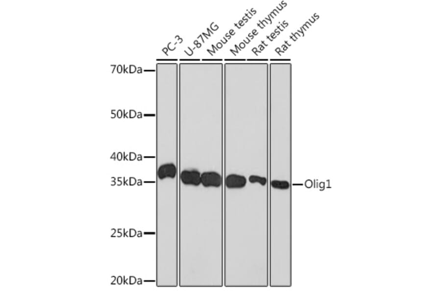 Western Blot - Anti-Olig1 Antibody [ARC1850] (A308528) - Antibodies.com