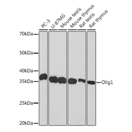 Western Blot - Anti-Olig1 Antibody [ARC1850] (A308528) - Antibodies.com