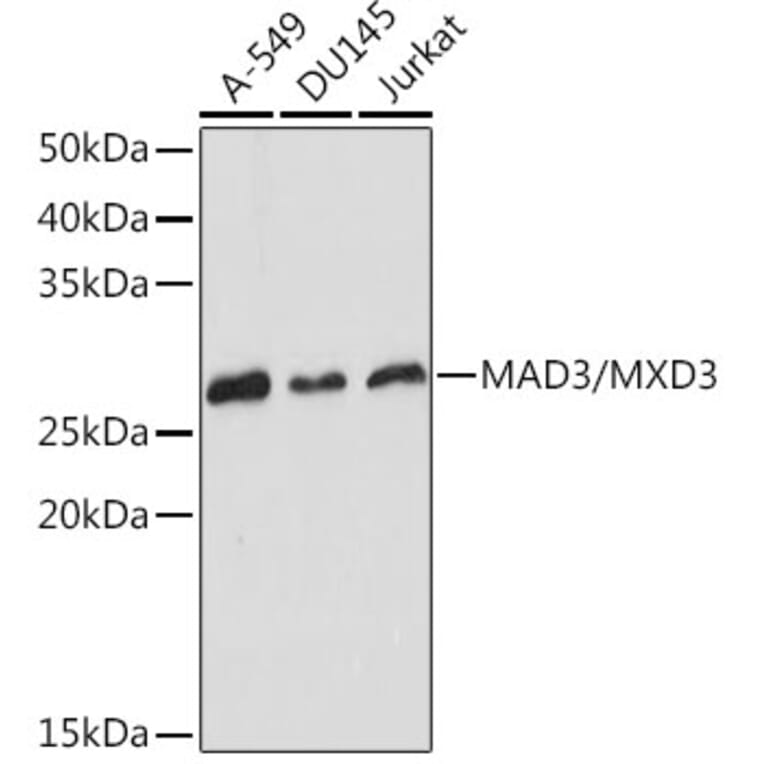 Western Blot - Anti-MXD3/MAD3 Antibody [ARC2333] (A308529) - Antibodies.com