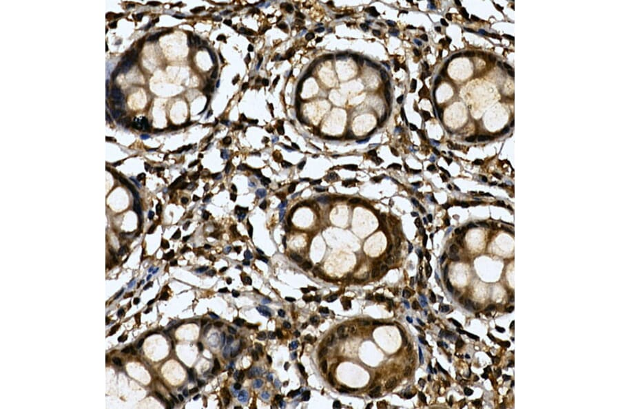 Immunohistochemistry - Anti-Tankyrase binding protein 1 Antibody (A308531) - Antibodies.com