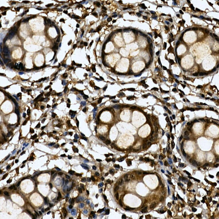 Immunohistochemistry - Anti-Tankyrase binding protein 1 Antibody (A308531) - Antibodies.com