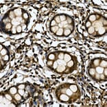 Immunohistochemistry - Anti-Tankyrase binding protein 1 Antibody (A308531) - Antibodies.com