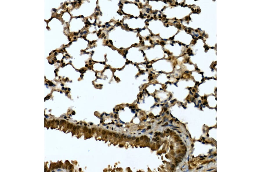 Immunohistochemistry - Anti-Tankyrase binding protein 1 Antibody (A308531) - Antibodies.com