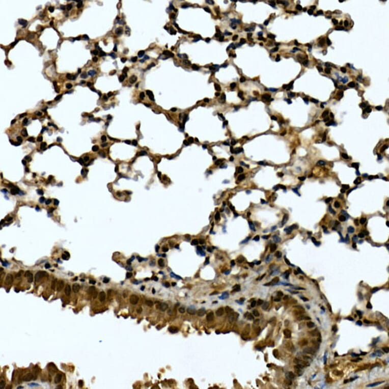 Immunohistochemistry - Anti-Tankyrase binding protein 1 Antibody (A308531) - Antibodies.com