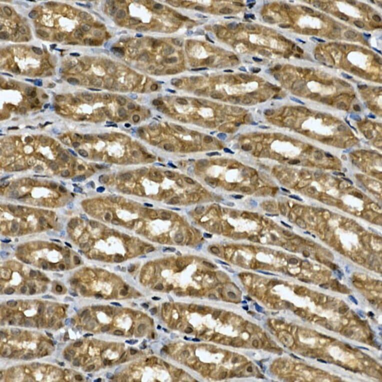 Immunohistochemistry - Anti-Tankyrase binding protein 1 Antibody (A308531) - Antibodies.com