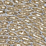 Immunohistochemistry - Anti-Tankyrase binding protein 1 Antibody (A308531) - Antibodies.com