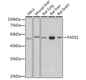 Western Blot - Anti-FADS1 Antibody [ARC2499] (A308532) - Antibodies.com