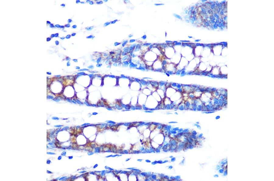 Immunohistochemistry - Anti-BMP4 Antibody [ARC0587] (A308533) - Antibodies.com