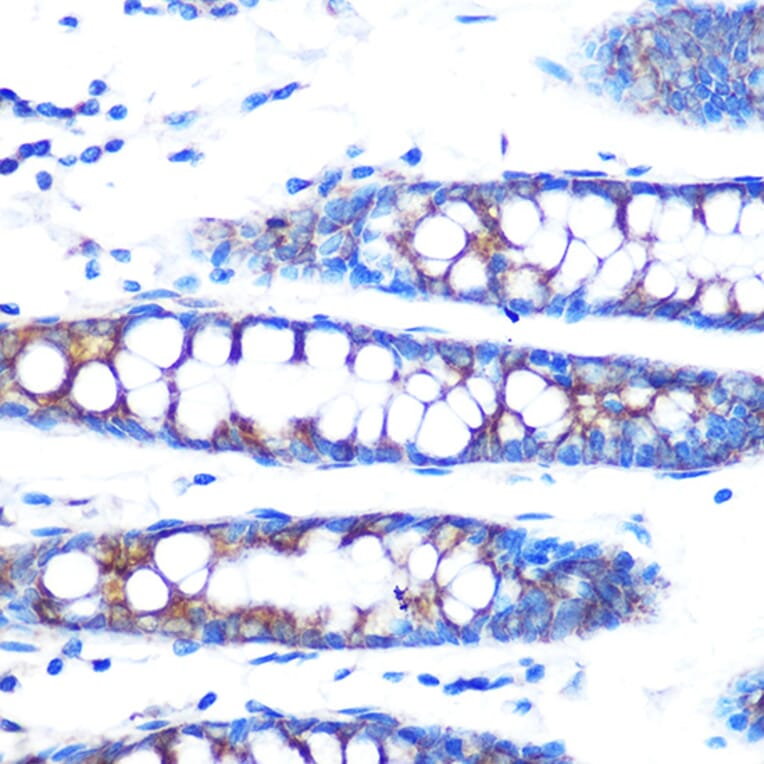 Immunohistochemistry - Anti-BMP4 Antibody [ARC0587] (A308533) - Antibodies.com