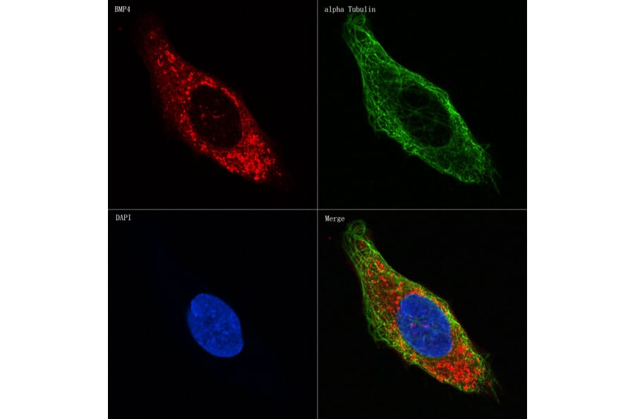 Immunofluorescence - Anti-BMP4 Antibody [ARC0587] (A308533) - Antibodies.com
