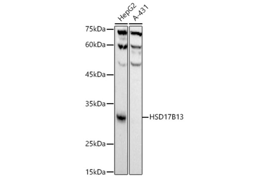 Western Blot - Anti-HSD17B13 Antibody [ARC52038] (A308534) - Antibodies.com