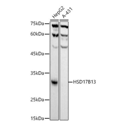 Western Blot - Anti-HSD17B13 Antibody [ARC52038] (A308534) - Antibodies.com