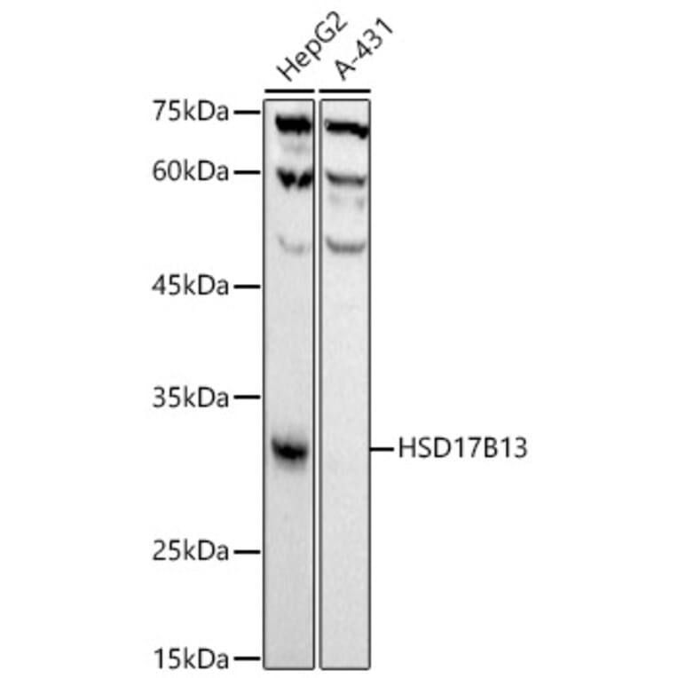 Western Blot - Anti-HSD17B13 Antibody [ARC52038] (A308534) - Antibodies.com