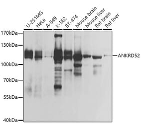Western Blot - Anti-ANKRD52 Antibody (A308535) - Antibodies.com