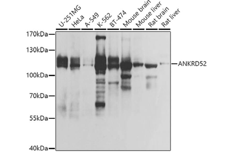 Western Blot - Anti-ANKRD52 Antibody (A308535) - Antibodies.com