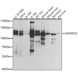 Western Blot - Anti-ANKRD52 Antibody (A308535) - Antibodies.com