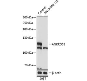 Western Blot - Anti-ANKRD52 Antibody (A308536) - Antibodies.com