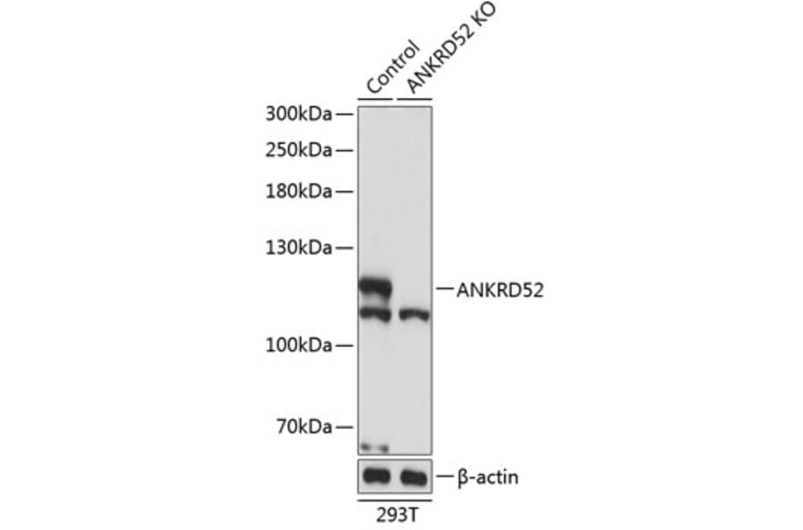 Western Blot - Anti-ANKRD52 Antibody (A308536) - Antibodies.com