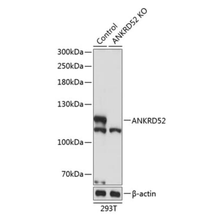 Western Blot - Anti-ANKRD52 Antibody (A308536) - Antibodies.com