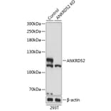Western Blot - Anti-ANKRD52 Antibody (A308536) - Antibodies.com