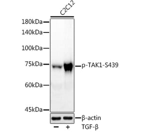 Western Blot - Anti-TAK1 (phospho Ser439) Antibody [ARC2714] (A308538) - Antibodies.com