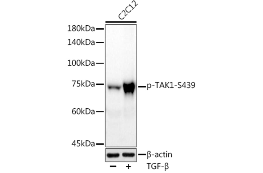 Western Blot - Anti-TAK1 (phospho Ser439) Antibody [ARC2714] (A308538) - Antibodies.com