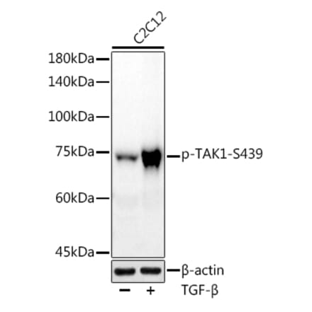 Western Blot - Anti-TAK1 (phospho Ser439) Antibody [ARC2714] (A308538) - Antibodies.com