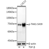 Western Blot - Anti-TAK1 (phospho Ser439) Antibody [ARC2714] (A308538) - Antibodies.com