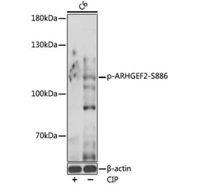 Western Blot - Anti-GEF H1 (phospho Ser886) Antibody (A308539) - Antibodies.com