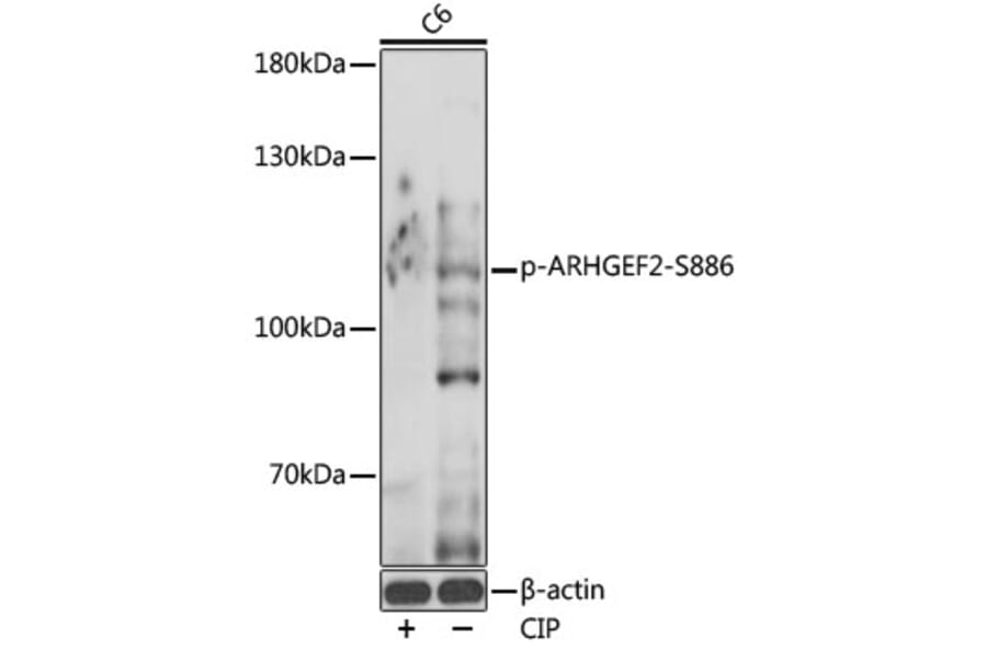 Western Blot - Anti-GEF H1 (phospho Ser886) Antibody (A308539) - Antibodies.com