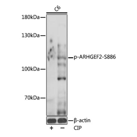 Western Blot - Anti-GEF H1 (phospho Ser886) Antibody (A308539) - Antibodies.com