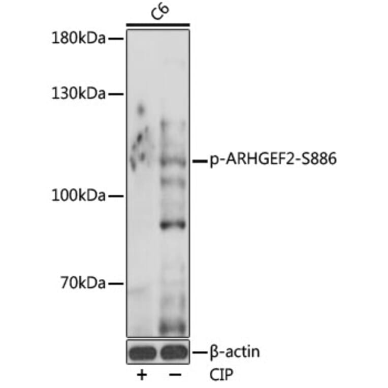 Western Blot - Anti-GEF H1 (phospho Ser886) Antibody (A308539) - Antibodies.com