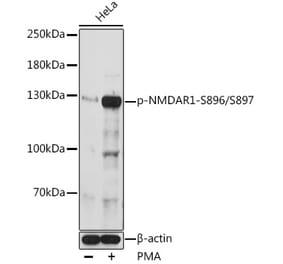 Western Blot - Anti-NMDAR1 (phospho Ser896 + Ser897) Antibody (A308540) - Antibodies.com