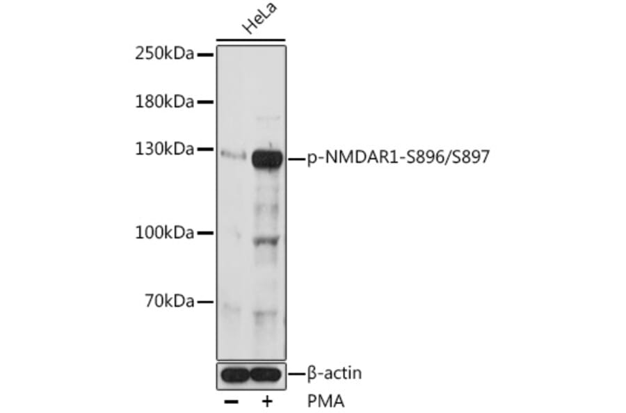 Western Blot - Anti-NMDAR1 (phospho Ser896 + Ser897) Antibody (A308540) - Antibodies.com
