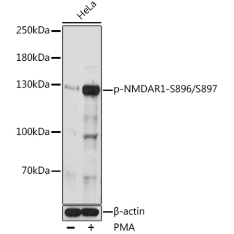 Western Blot - Anti-NMDAR1 (phospho Ser896 + Ser897) Antibody (A308540) - Antibodies.com