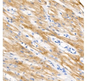 Immunohistochemistry - Anti-Cardiac Troponin I (phospho Ser23 + Ser24) Antibody (A308541) - Antibodies.com